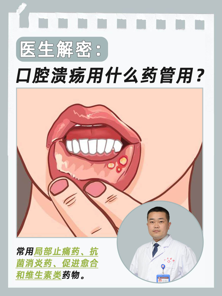 请问口疮是怎么回事??