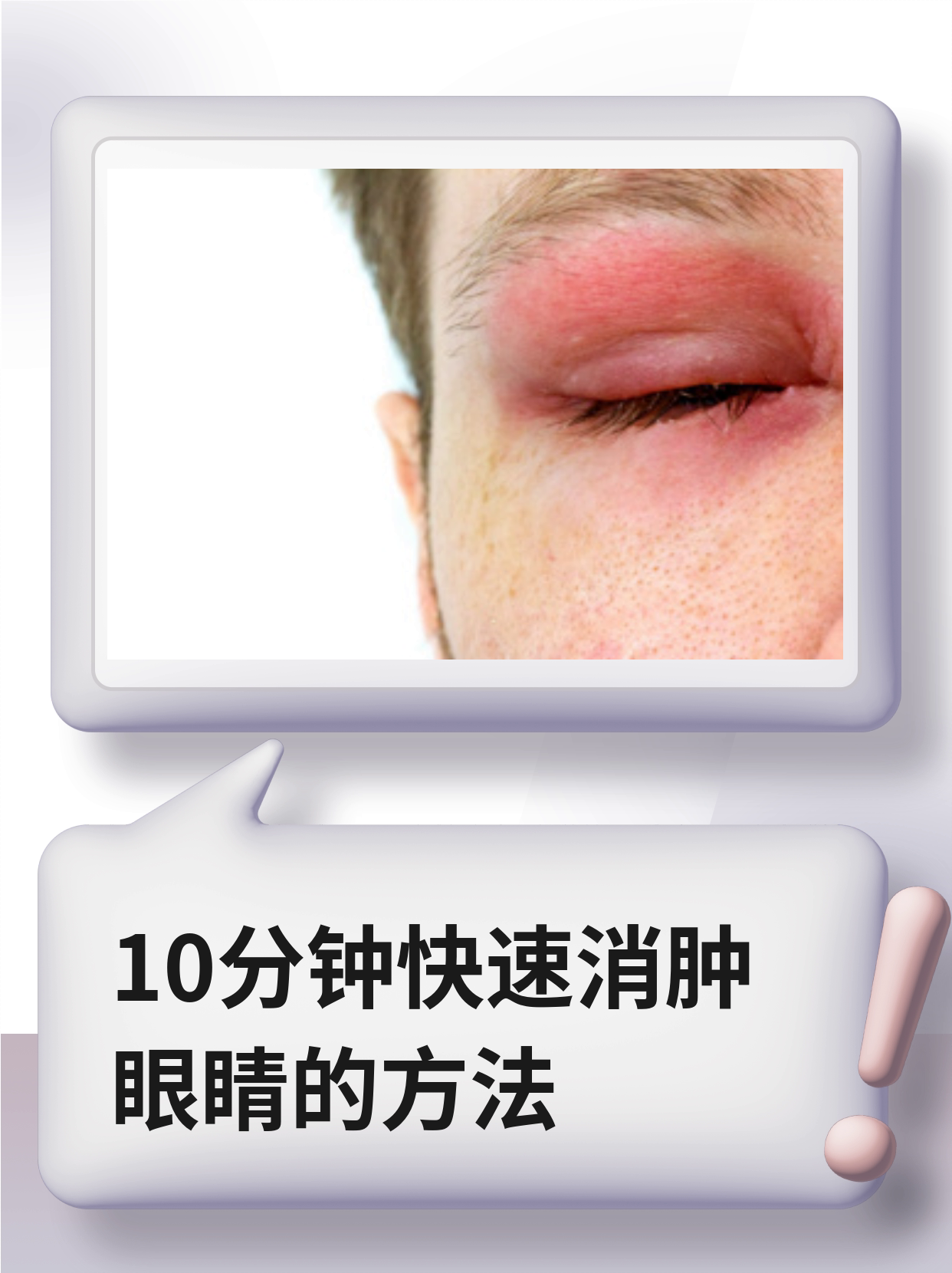 撞到脸脸肿怎么快速消肿