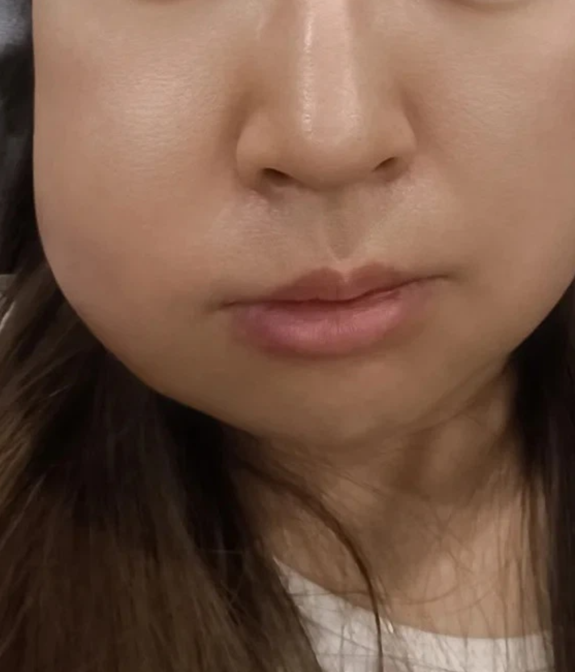 撞到脸脸肿怎么快速消肿