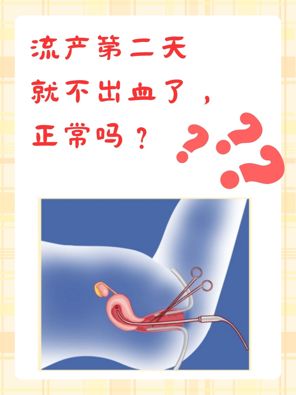 人流后流血多久正常