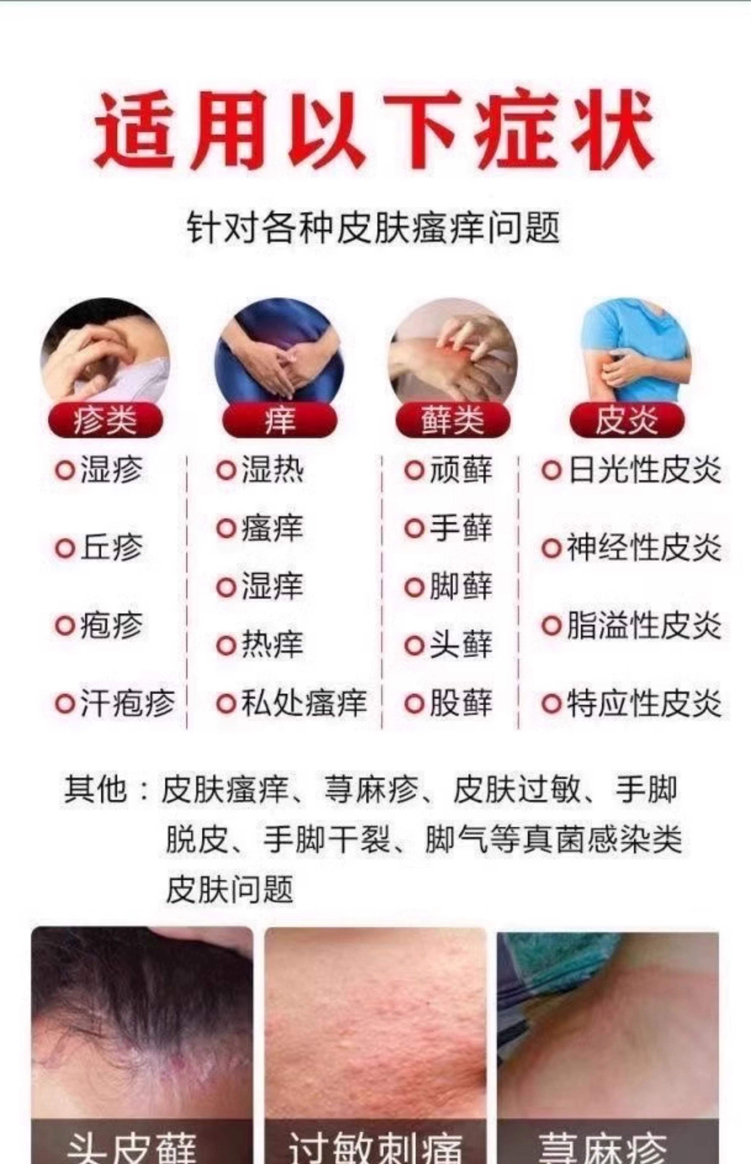 全身过敏很痒怎么办