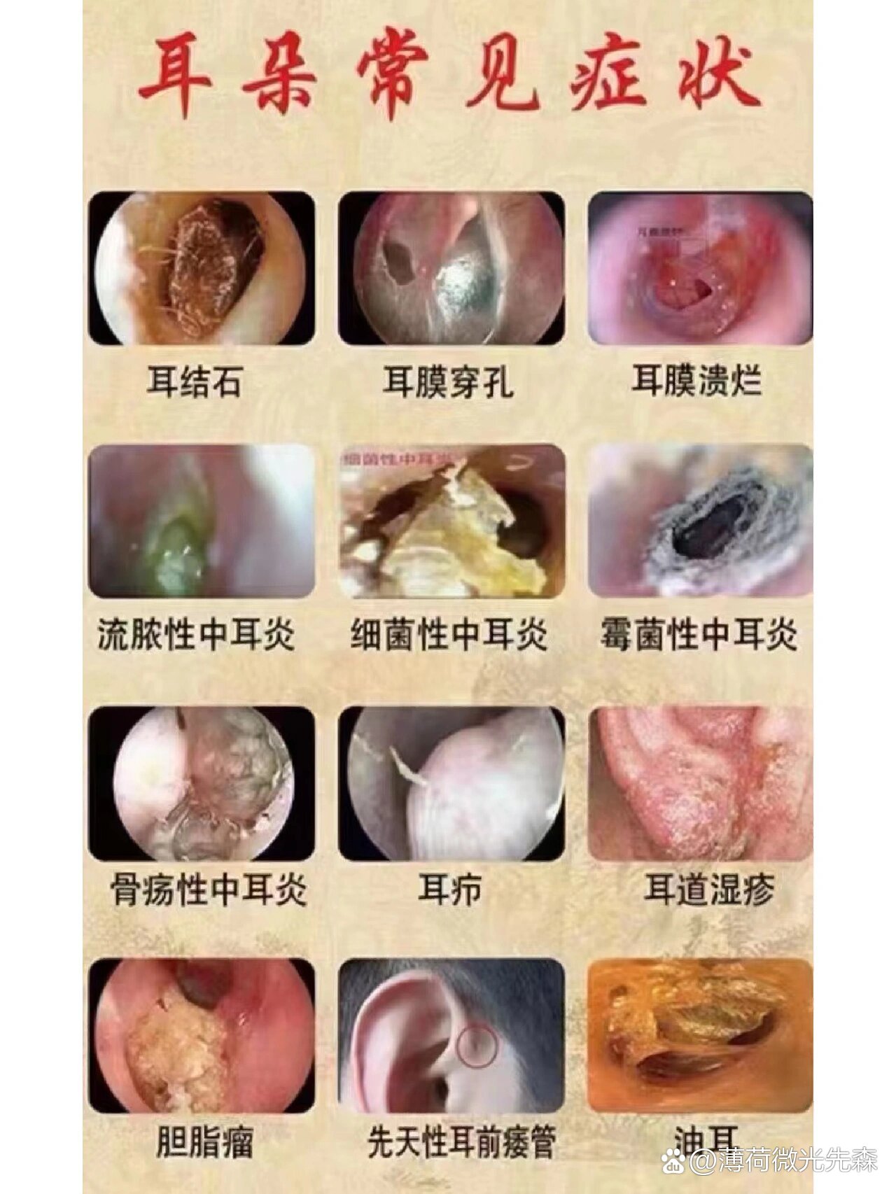 耳朵里痒是怎么回事