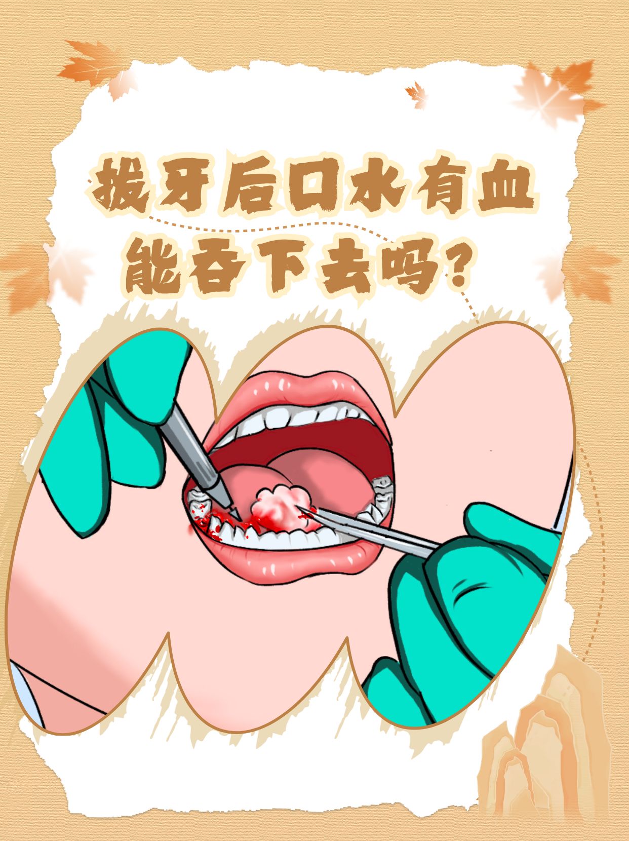 拔牙后出血不止怎么办