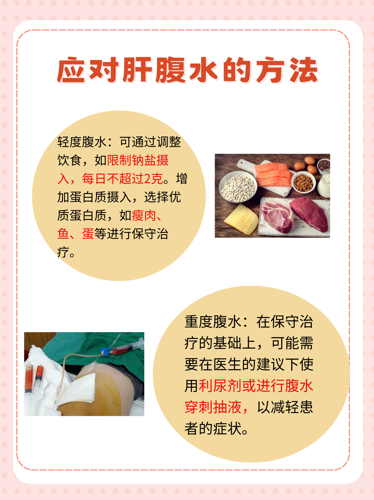 腹水的治疗方法