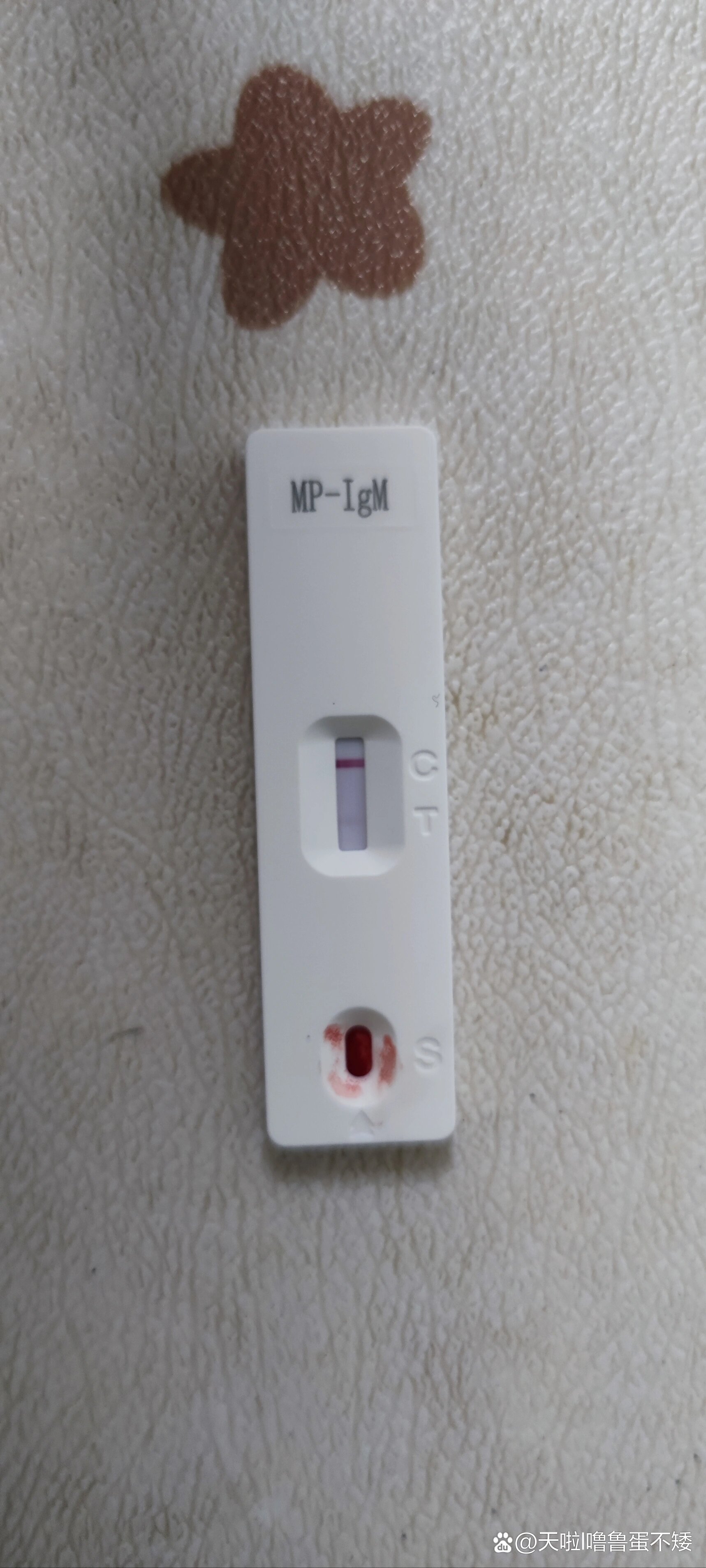 支原体肺炎弱阳性是什么意思