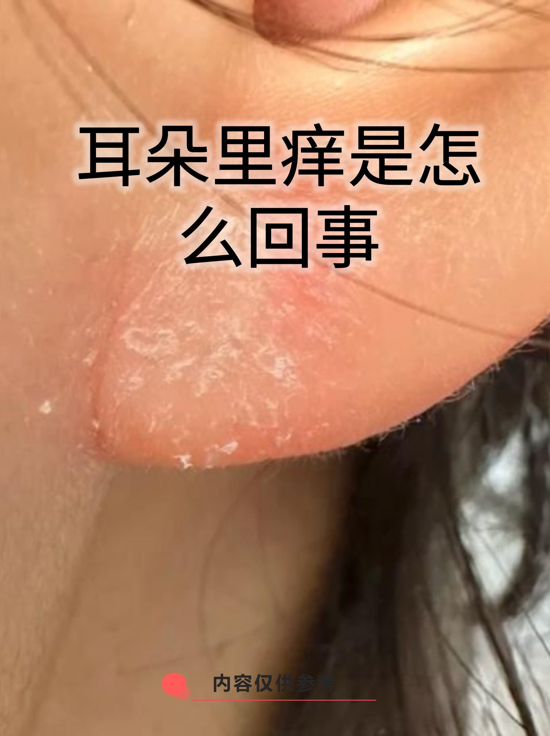 耳朵里面痒怎么治
