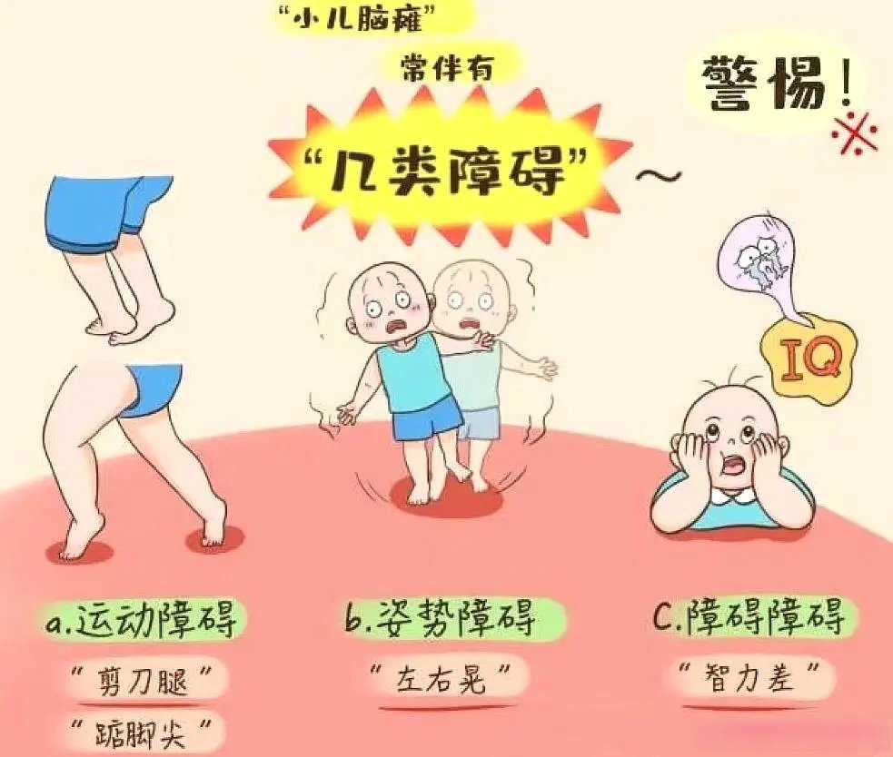 脑瘫是什么原因引起?