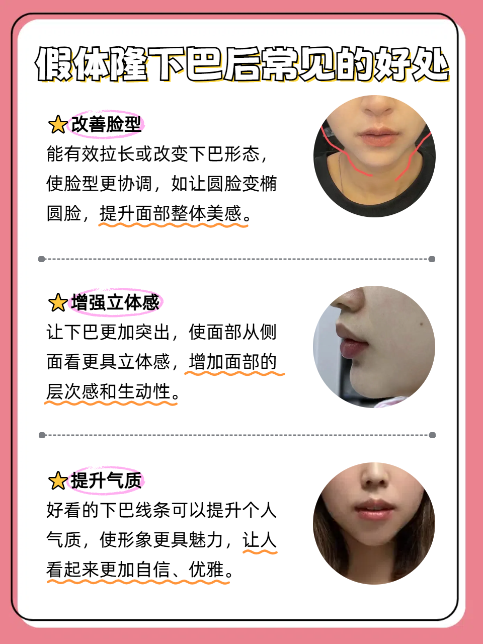 下巴错位会自己恢复吗