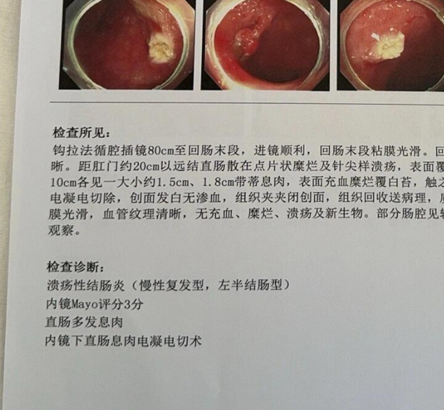 肚子疼拉血是什么回事