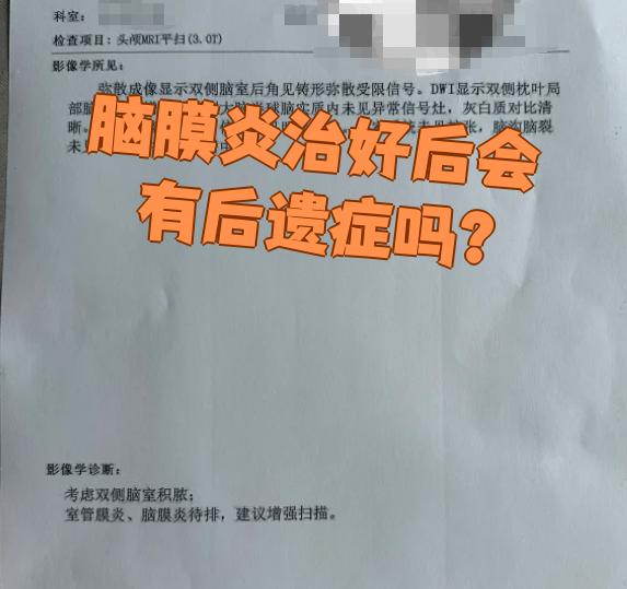 结核性脑膜炎能治好吗