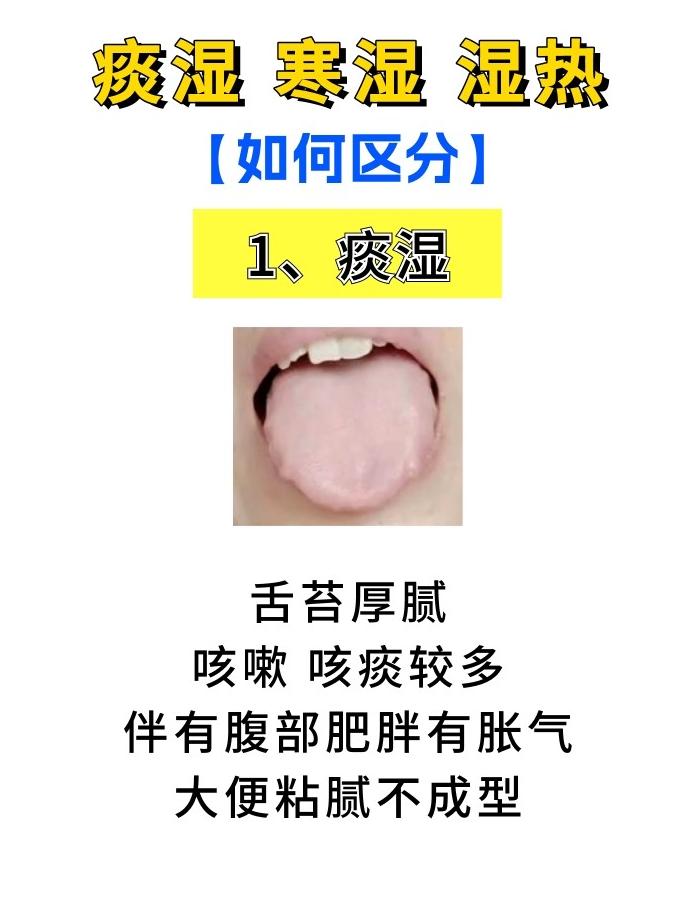 痰湿体质症状有哪些