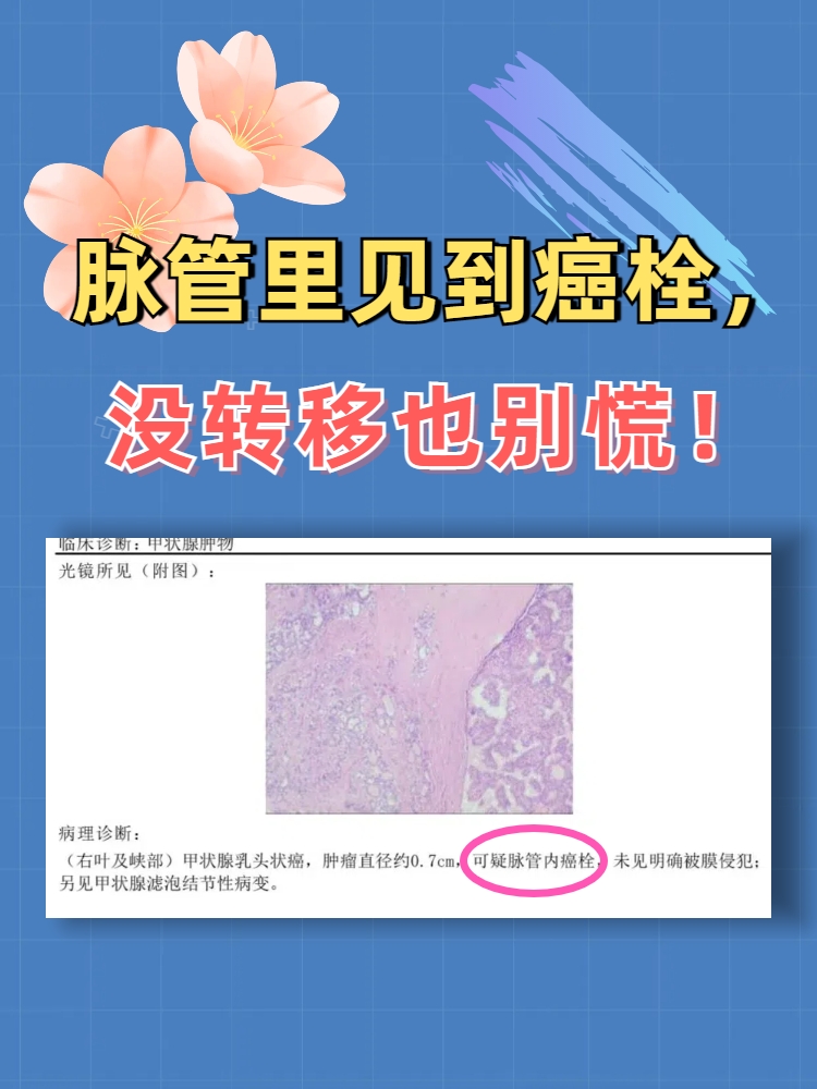 肿瘤坏死因子是什么意思?