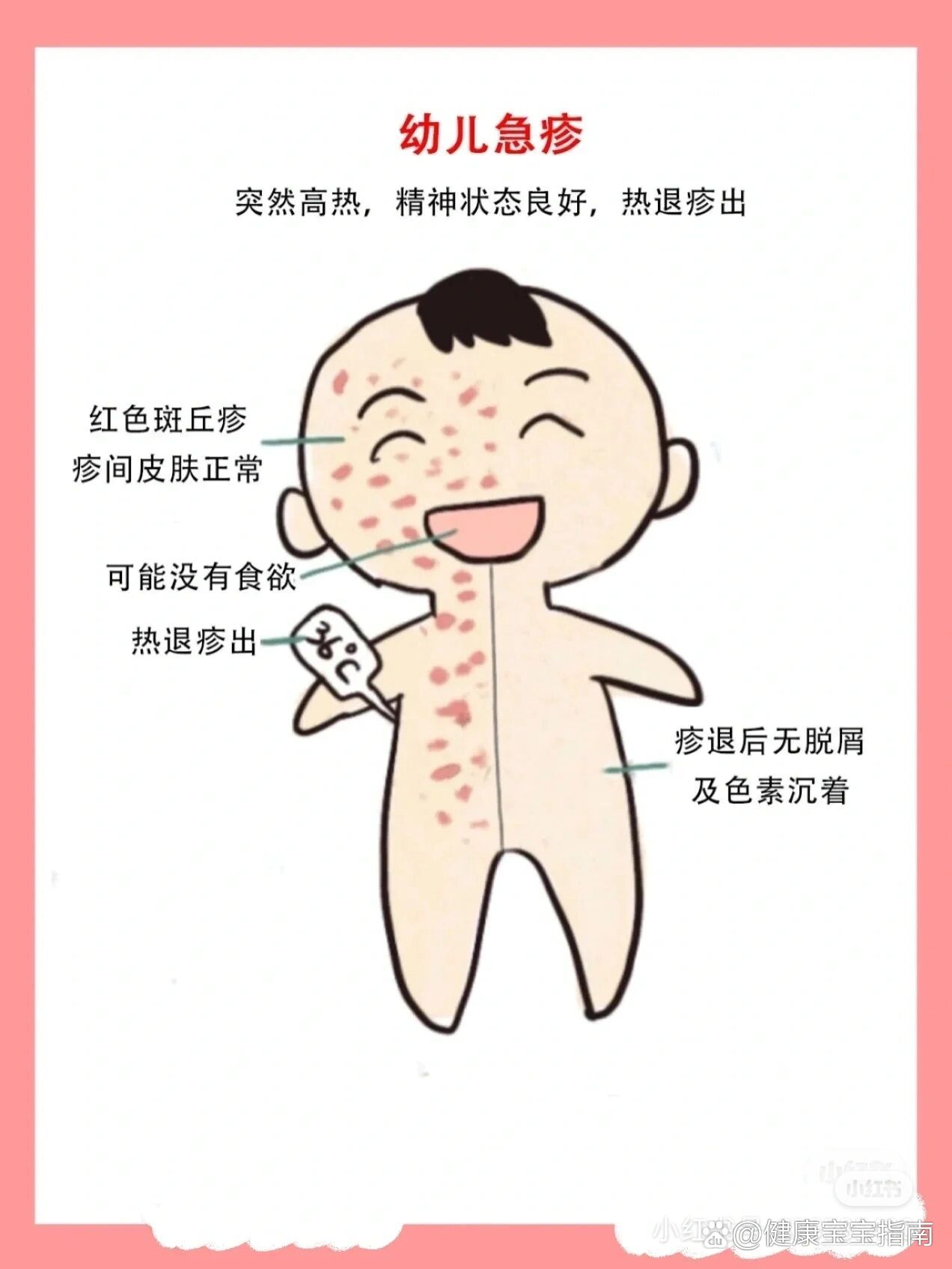 幼儿急疹的症状及护理