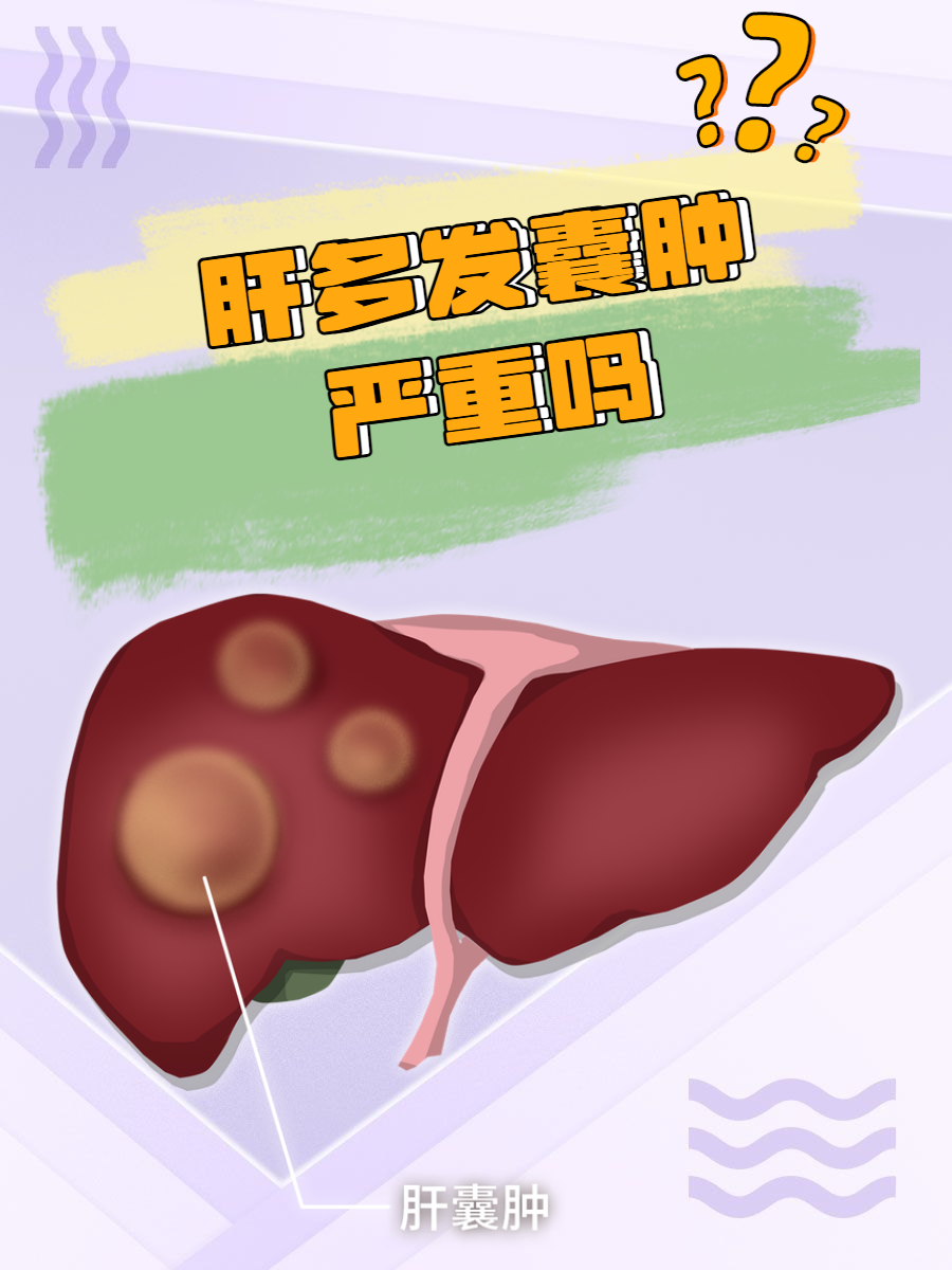 肝上长了囊肿怎么办