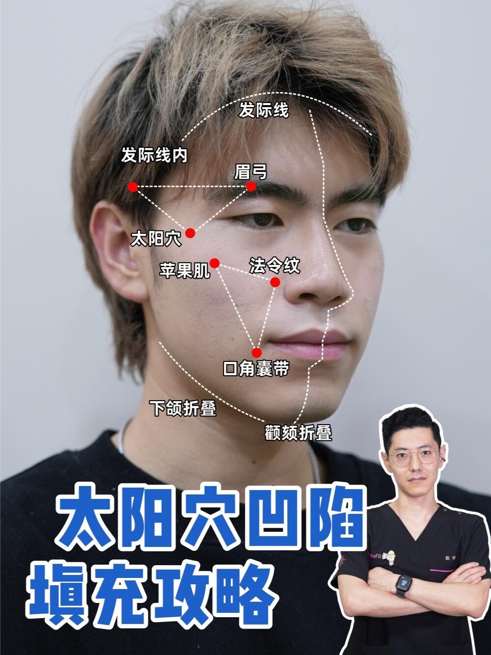 太阳穴疼怎么回事