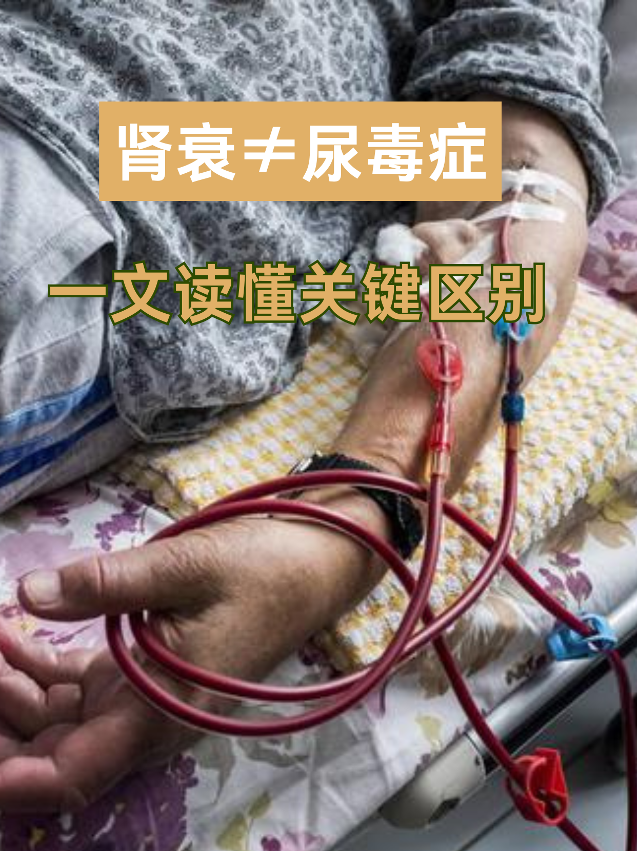 肾功能不全能治吗?