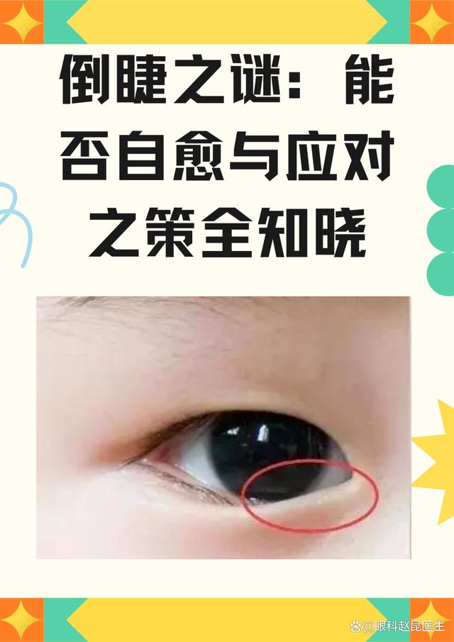 倒睫是哪些原因引起的?