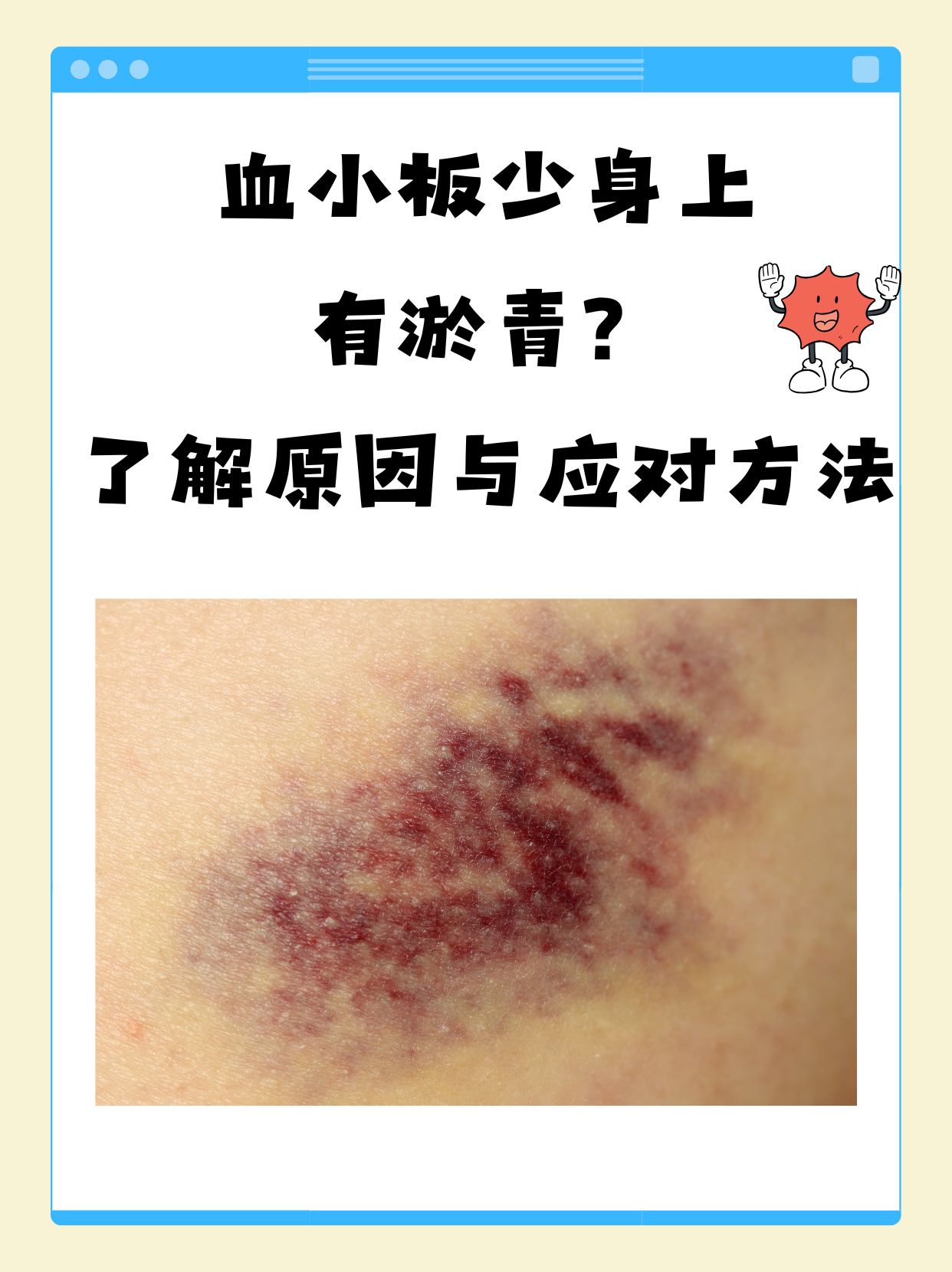 血小板低有什么危害