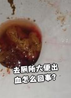 大便里有鲜血是怎么回事