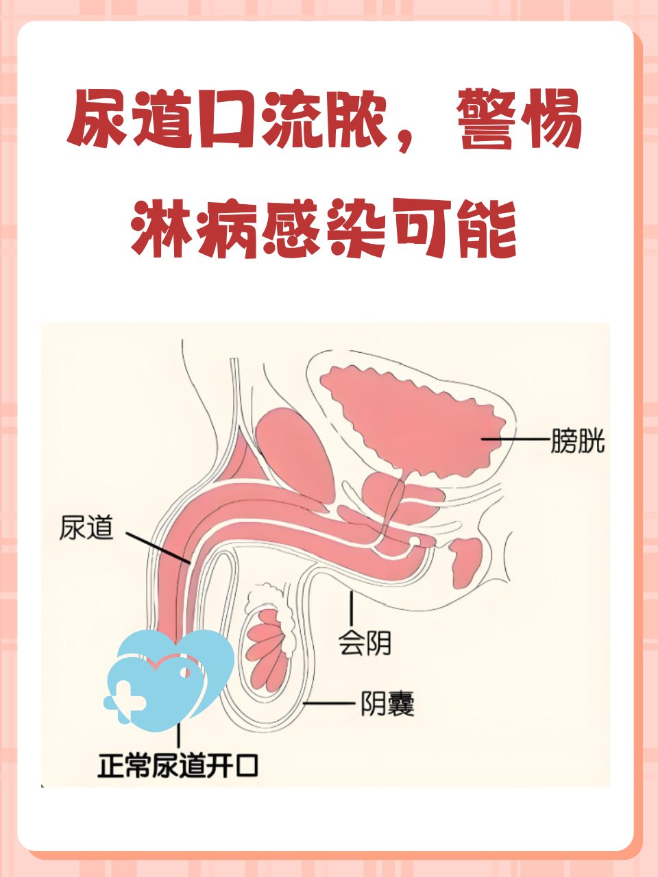 淋病是怎么得来的.