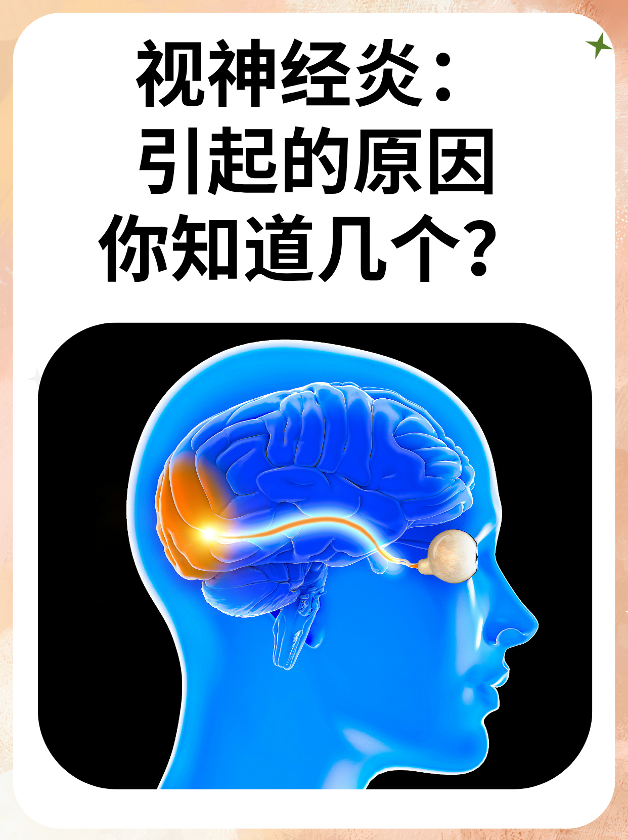 脊髓炎是怎么引起的?