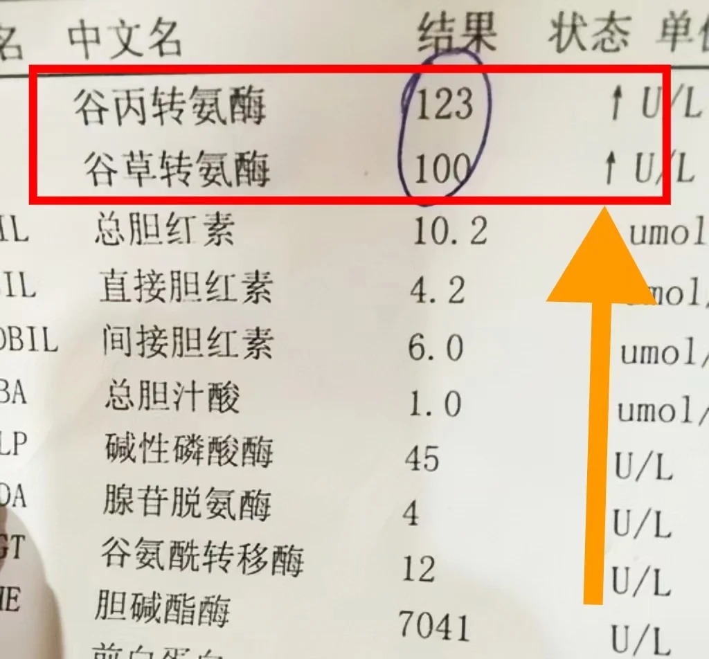 谷丙转氨酶高怎么快速降下来?