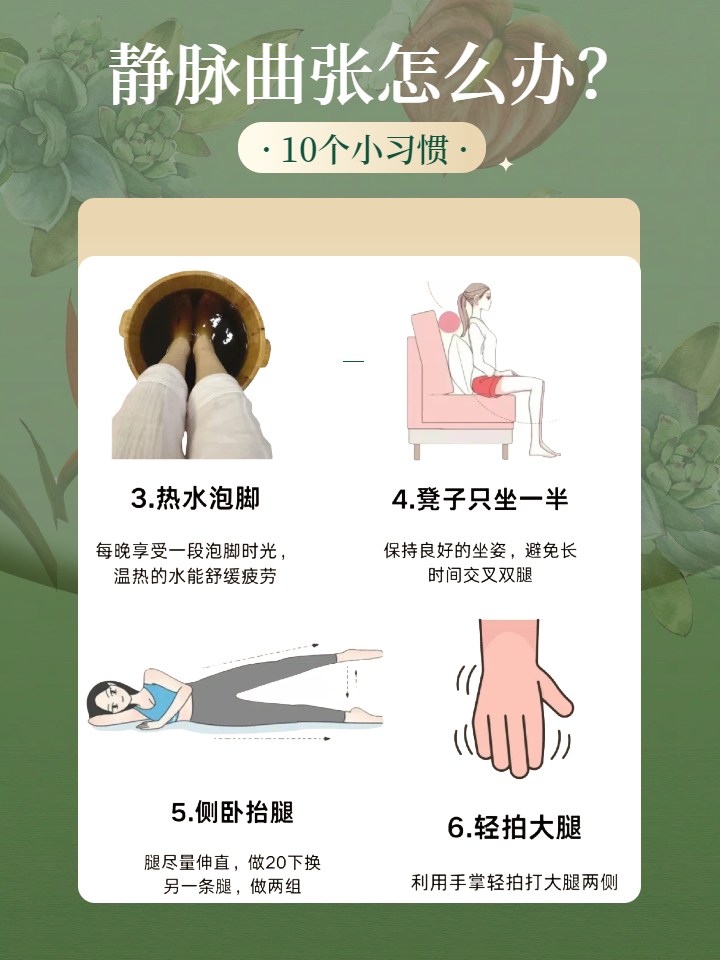 静脉曲张怎么预防缓解