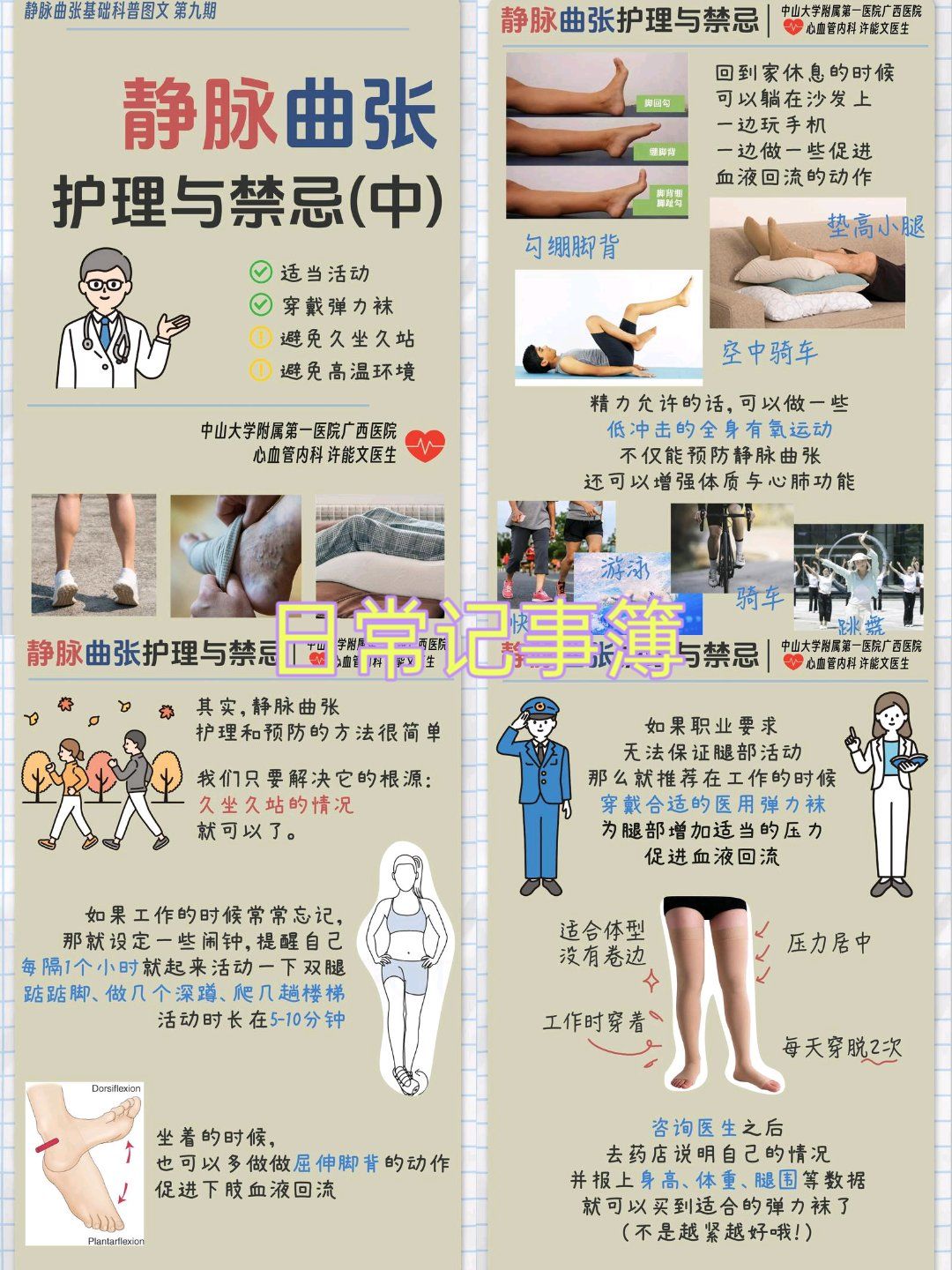 静脉曲张怎么预防缓解