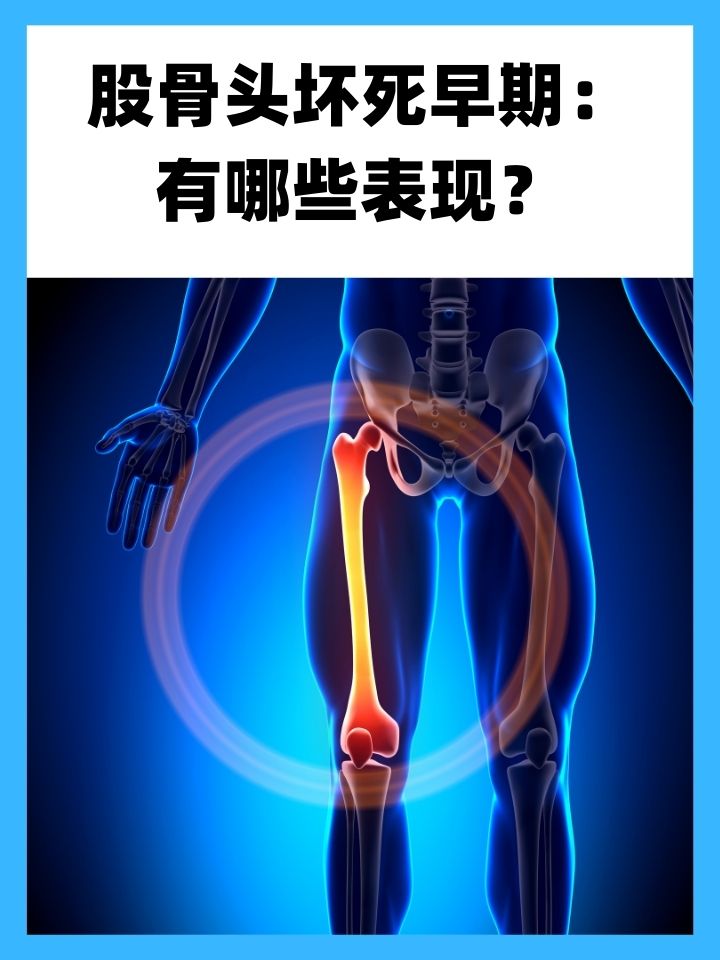 股骨头疼痛是怎么回事?