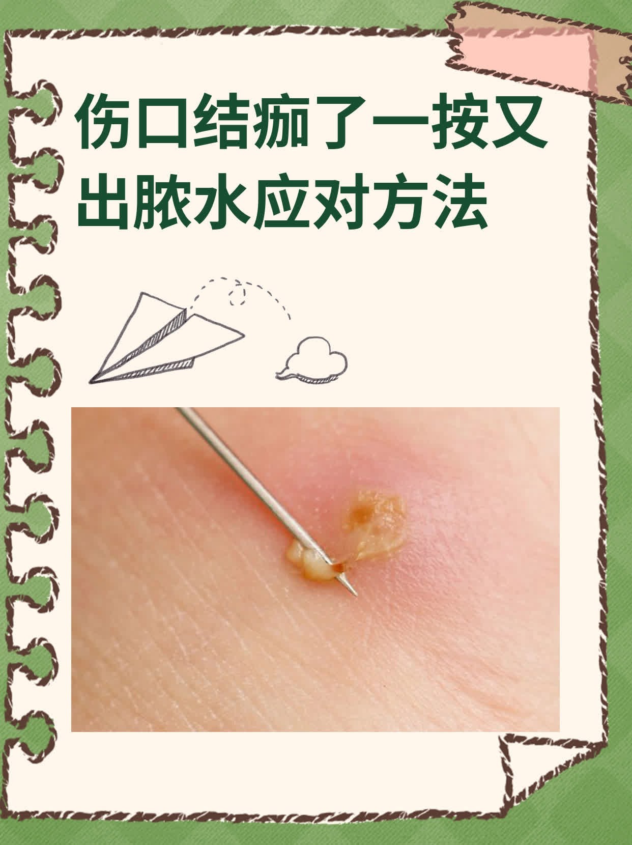 纱布黏在伤口上怎么办?