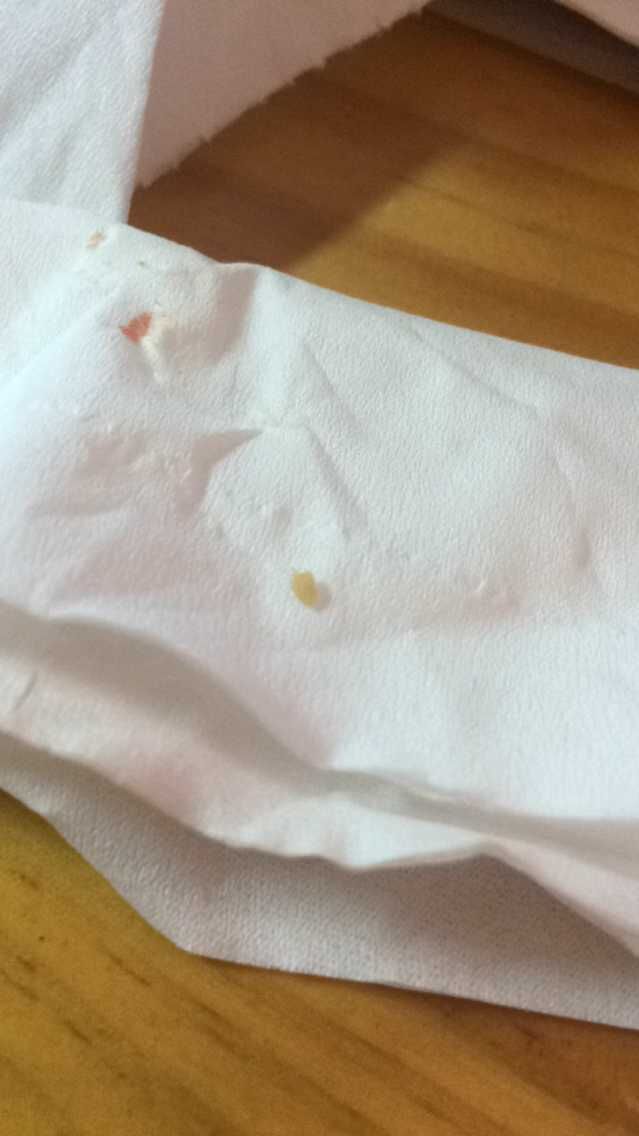 脸上的痘痘挤出来白色的东西是什么