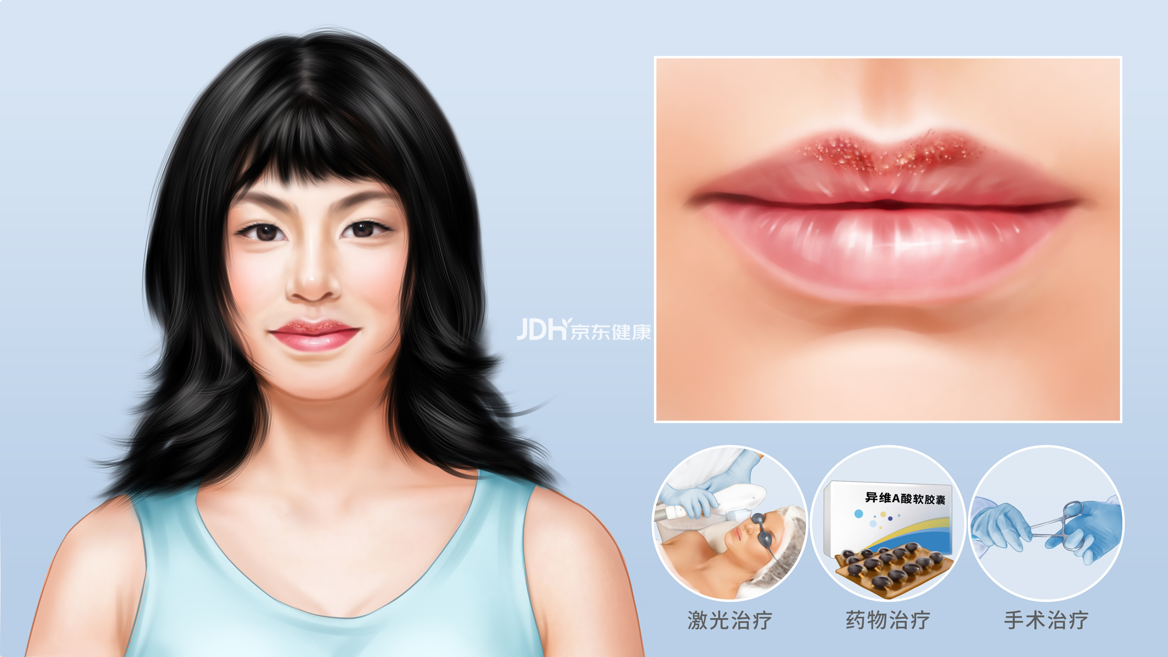 皮脂腺异位传染和遗传吗