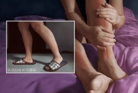 不安腿综合症能自愈吗