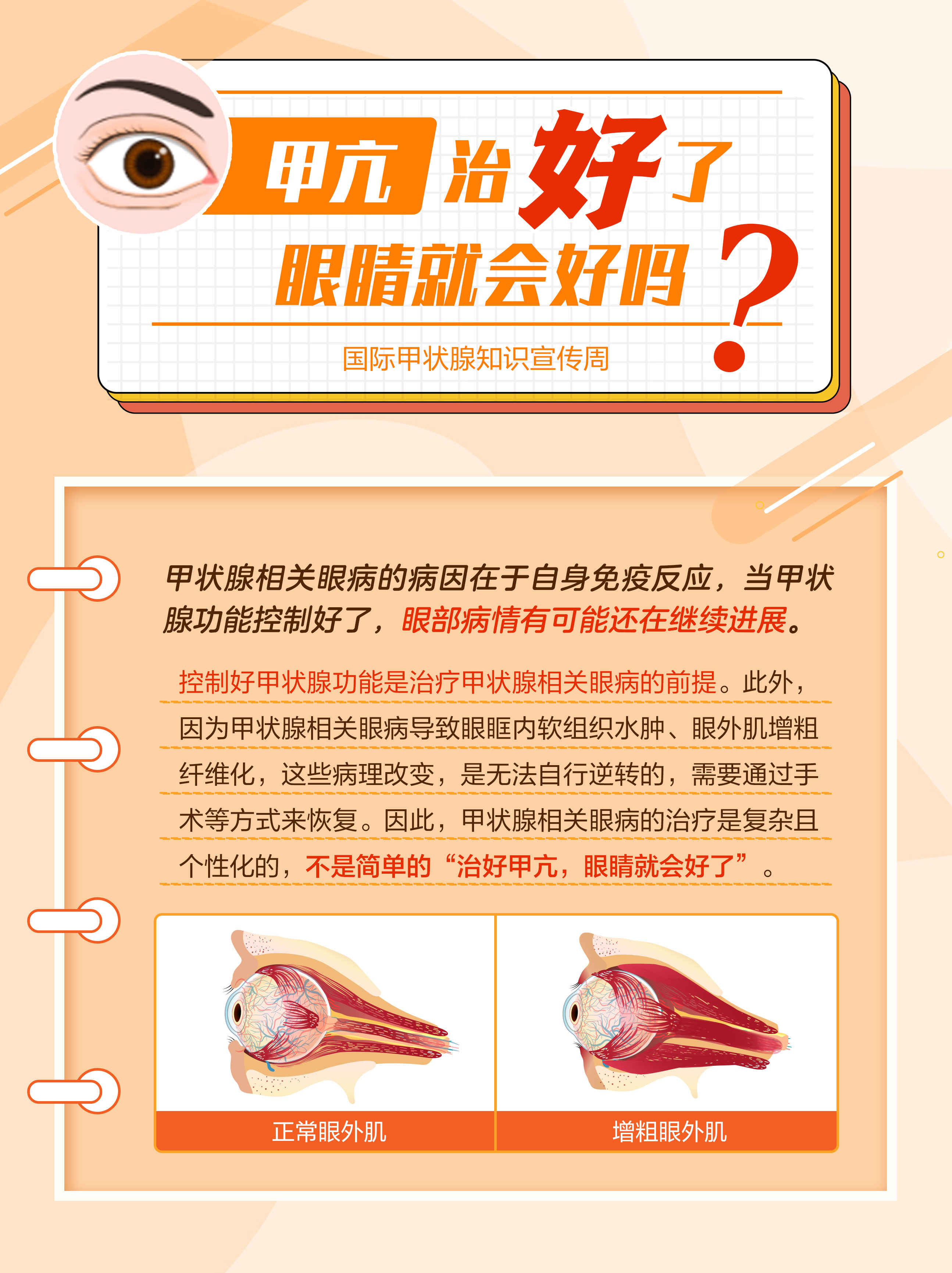 甲亢得了严重吗