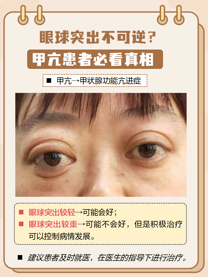 甲亢得了严重吗