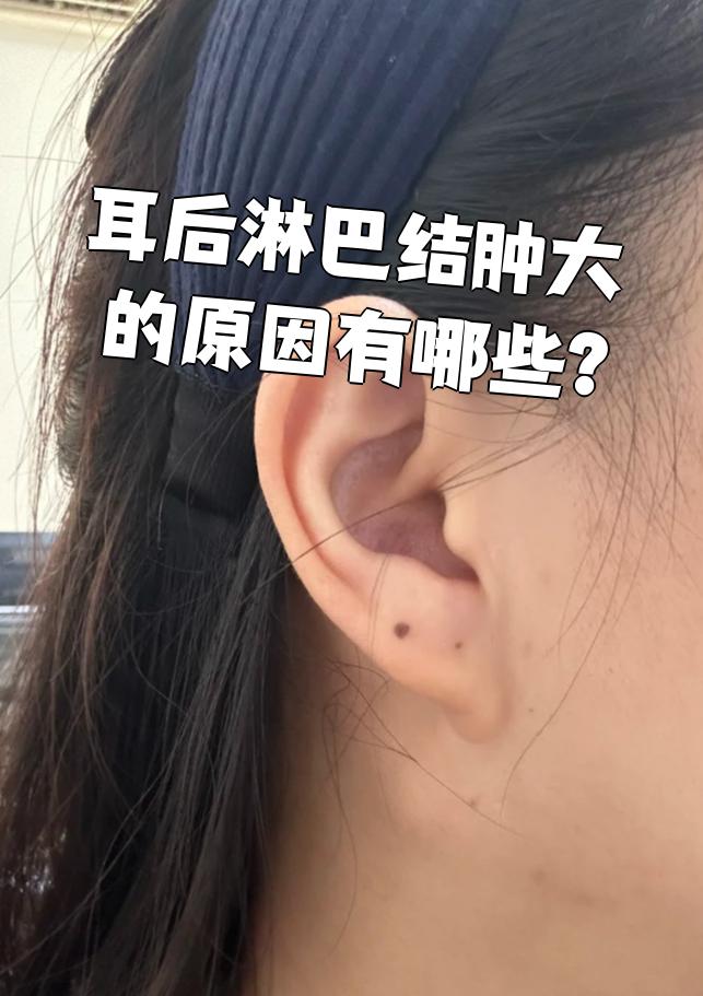 耳前淋巴结肿大的原因是什么?