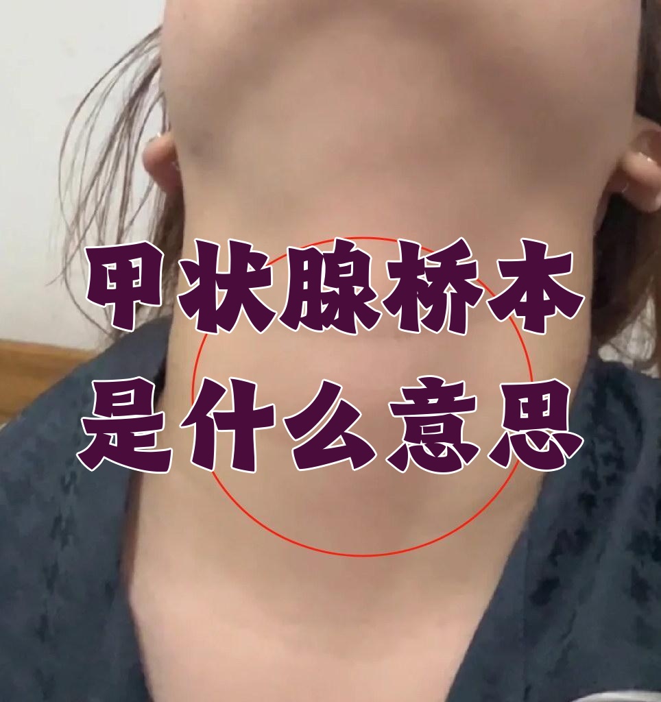 什么是桥本氏甲状腺炎?