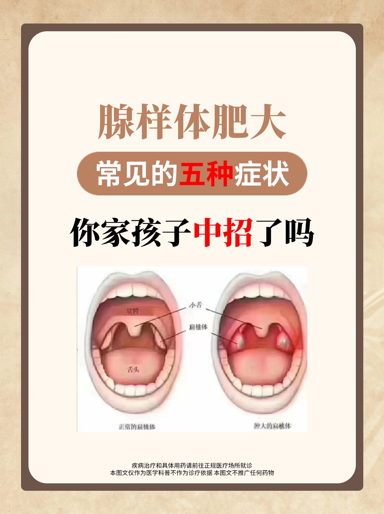 腺样体肥大的治疗方法有哪些