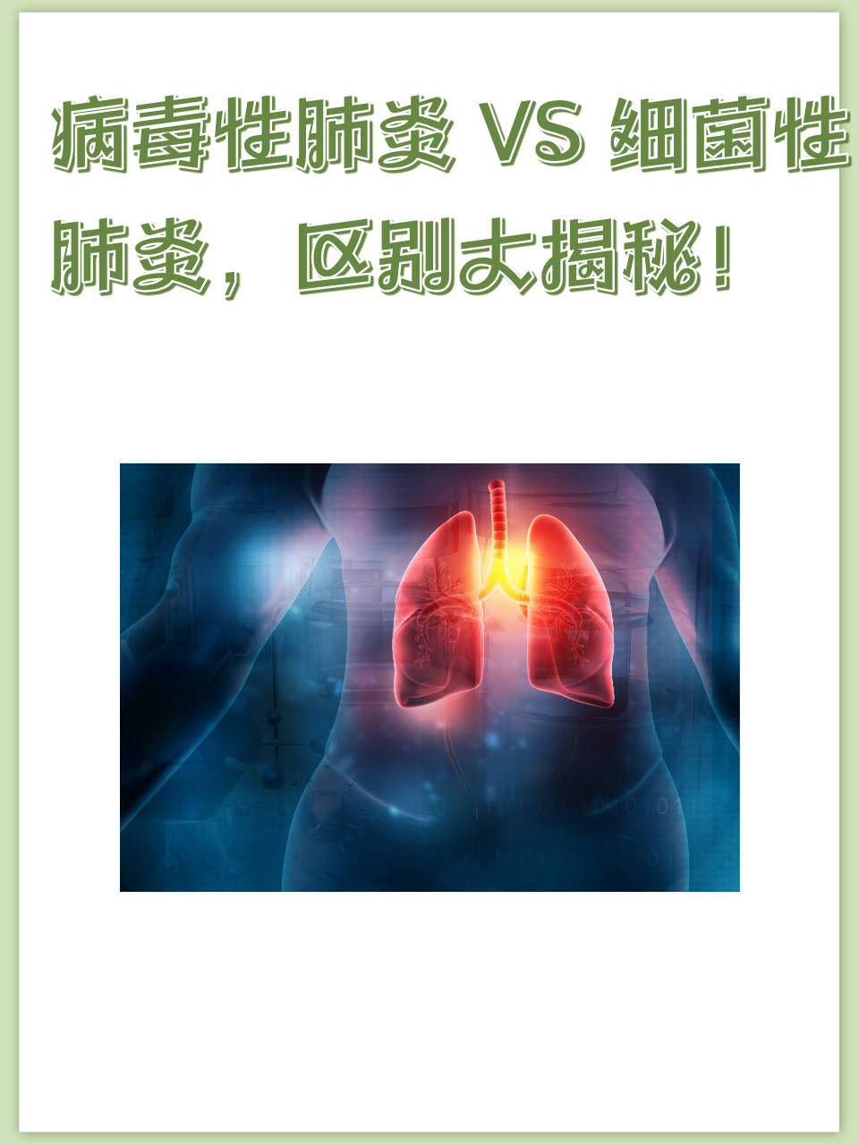 肺炎有哪些种类