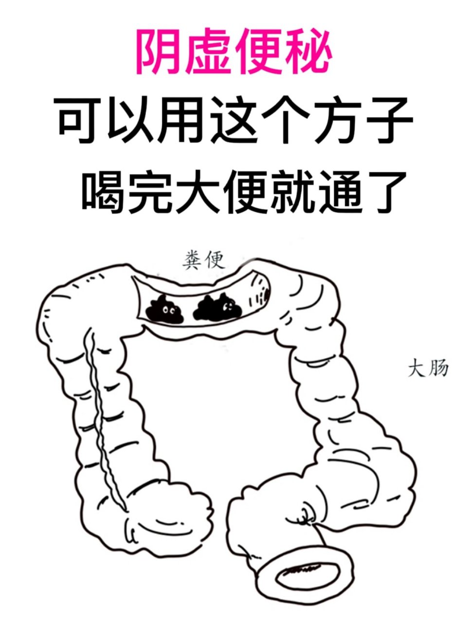 治疗便秘的偏方有哪些