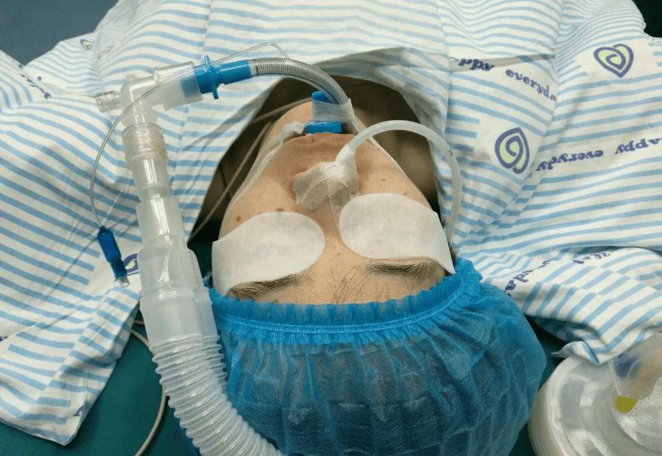 全身麻醉打哪个位置