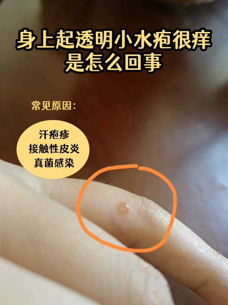 洗完澡身上很痒是怎么回事