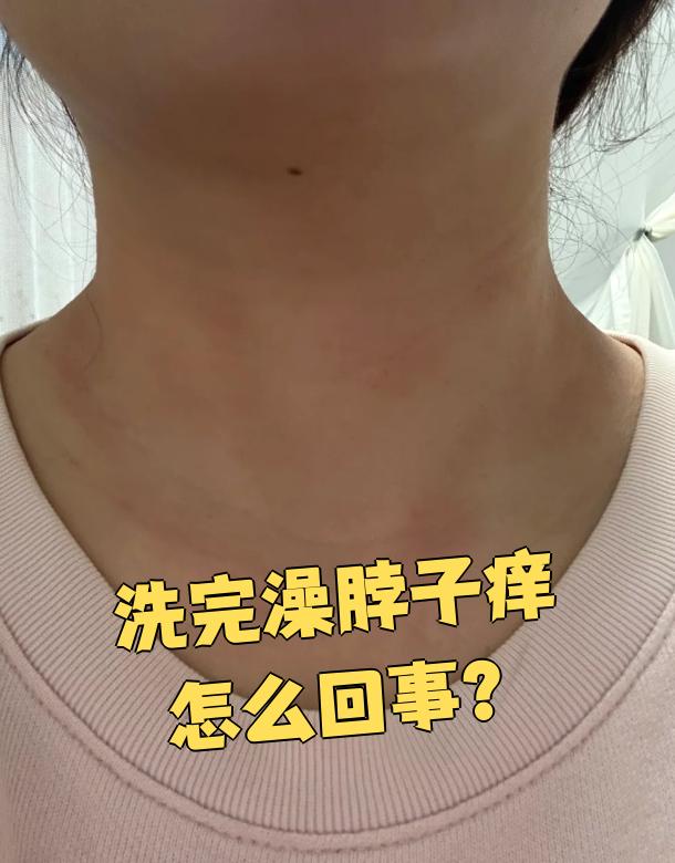 洗完澡身上很痒是怎么回事