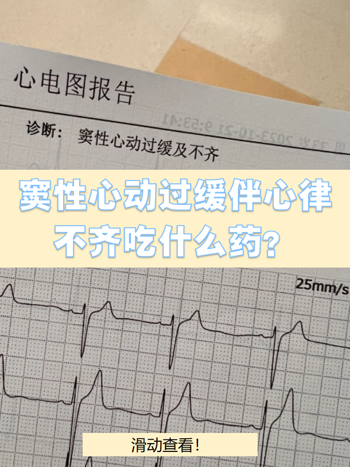 窦性心跳过速是心脏病吗?