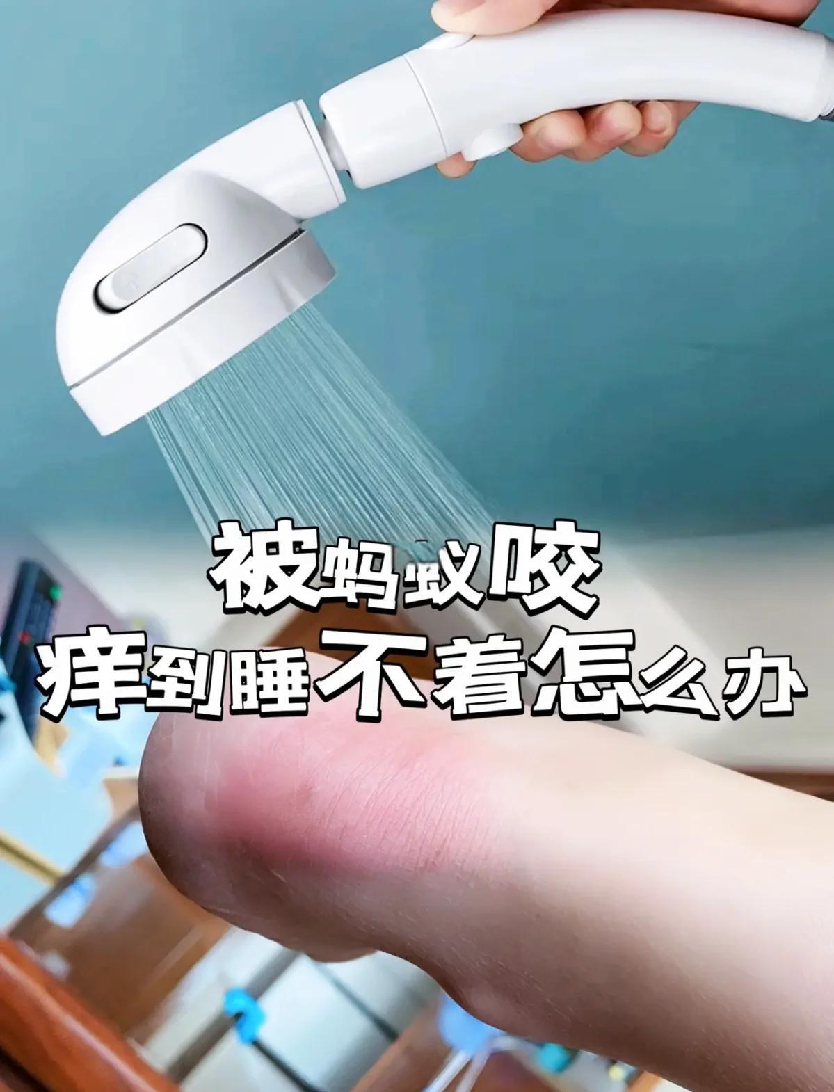 被壁虎咬了,怎么办