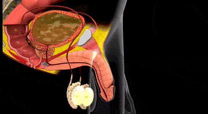 早上不勃起是怎么回事