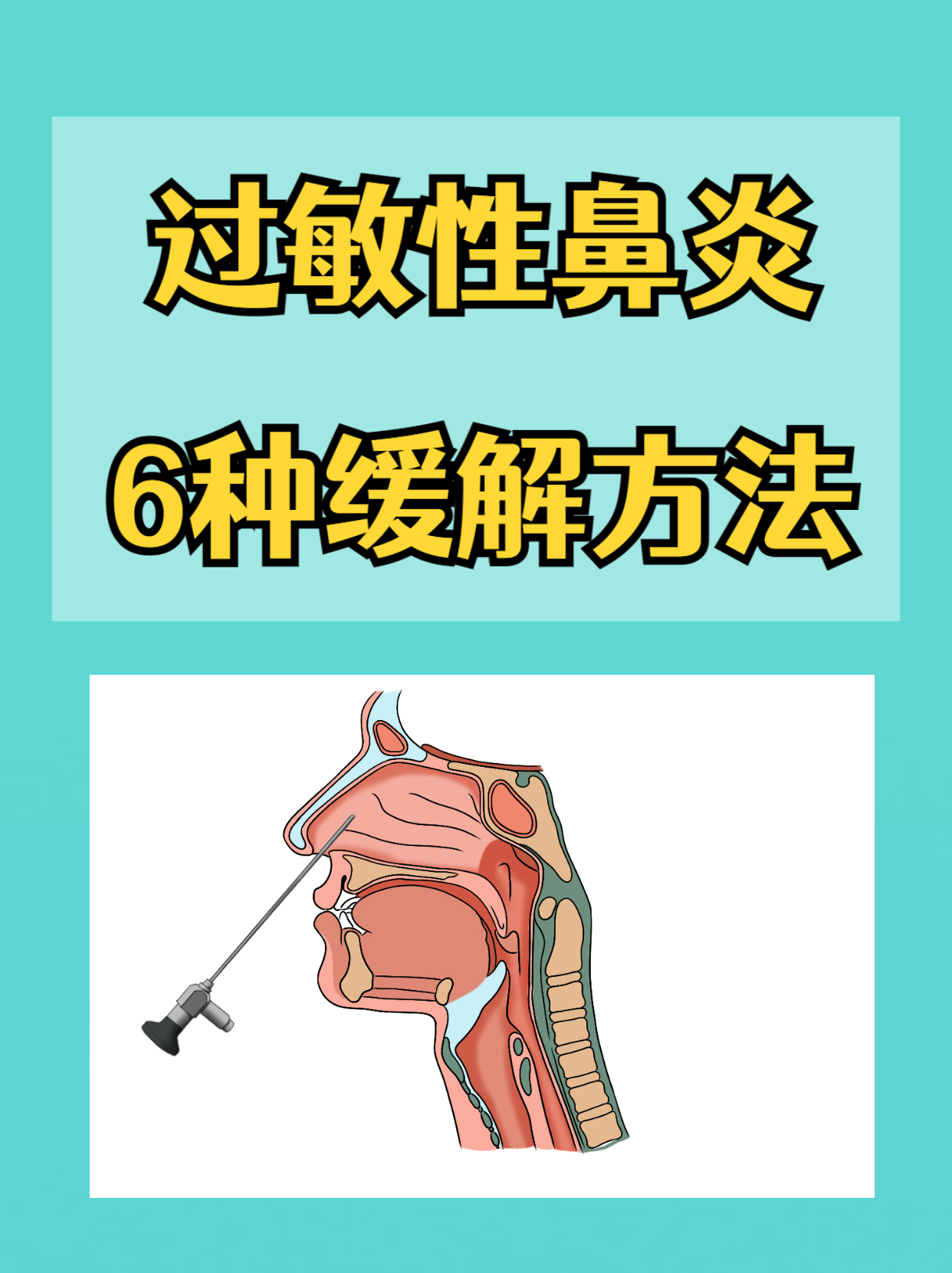 过敏性鼻炎怎么样缓解
