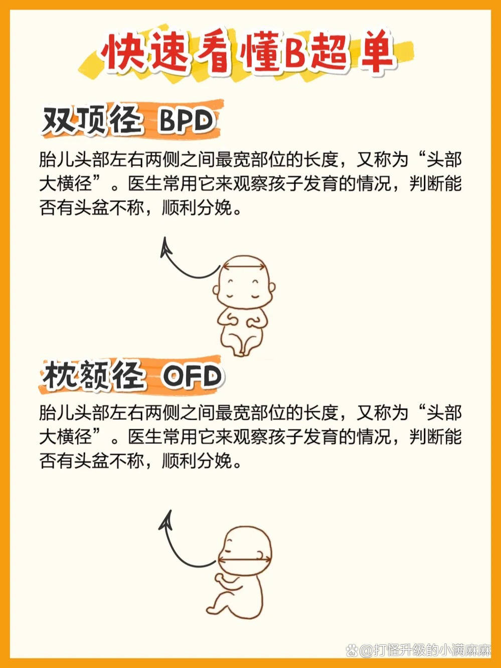 怎么样看B超单可以分出男女