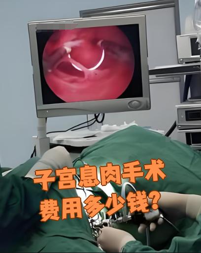 一般做宫腔镜手术需要多少钱