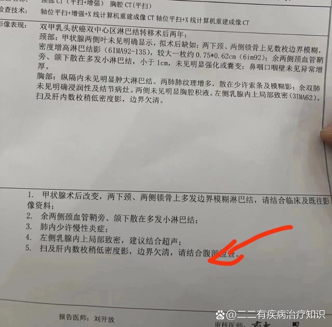 肝部有阴影可能会是什么